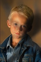 photograph of a boy with dark blotchy areas